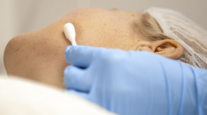 Medische Peeling Mesoestetic