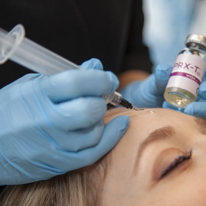 Trichloorazijnzuur peeling